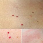 If you have a Red dots on your skin: Causes and what they could mean