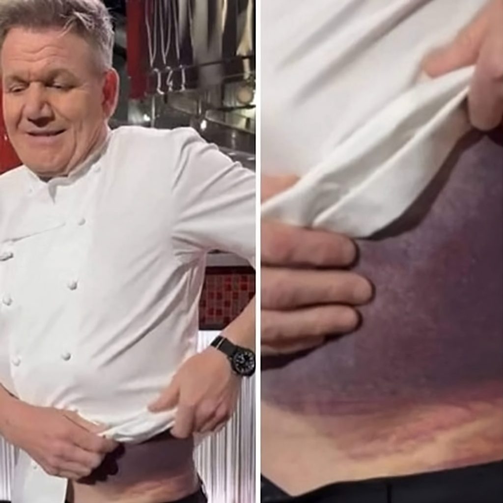 Gordon Ramsay’s Surprising Response to Life-Threatening Accident!