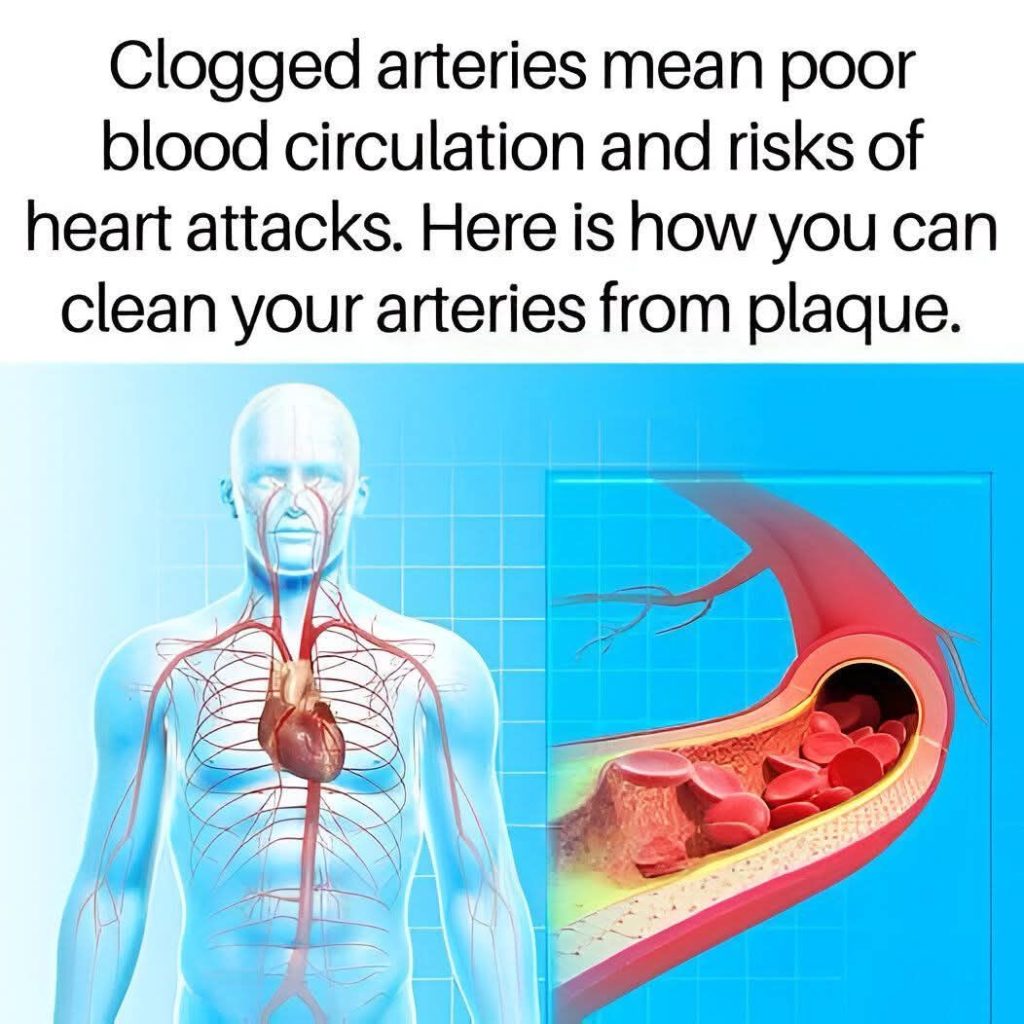 Clean Arteries: 10 Foods to Eat Daily