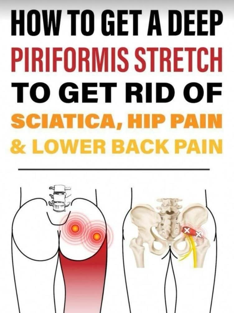 Effect Piriformis Stretch to Ease Lower Back, Hip, and Sciatic Nerve Pain
