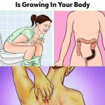 20 Early Signs Your Body is Fighting Cancer