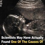 Scientists May Have Actually Found One Of The Causes Of Autism