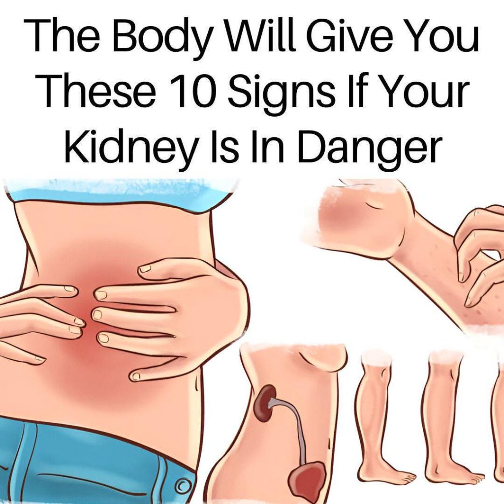 If Your Kidneys Are in Danger, the Body Will Show these 10 Signs
