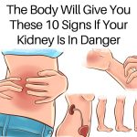If Your Kidneys Are in Danger, the Body Will Show these 10 Signs