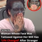 Woman Whose Face Was Tattooed Against Her Will Has ‘Life Changed’ After Stranger Offers To Help With Removal