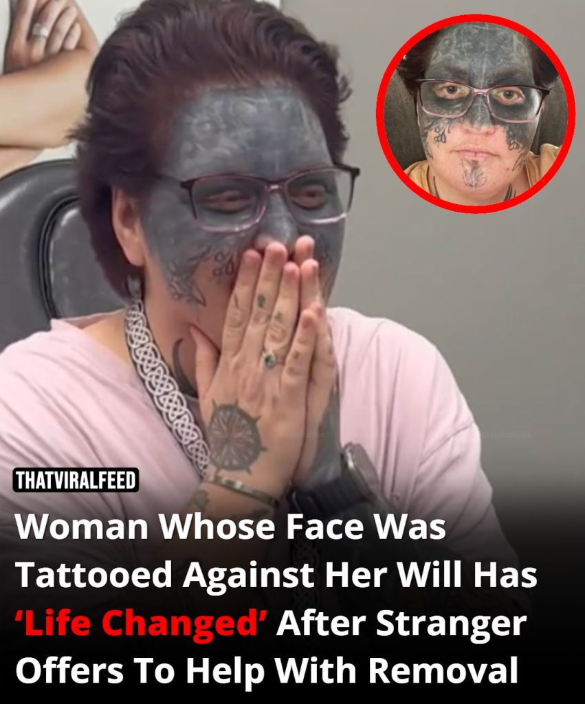 Woman Whose Face Was Tattooed Against Her Will Has ‘Life Changed’ After Stranger Offers To Help With Removal