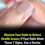 Doctor Reveals 7 Health Conditions You Can Spot By Just Checking Your Nails