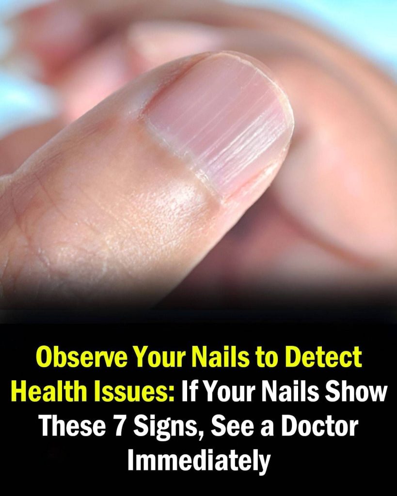 Doctor Reveals 7 Health Conditions You Can Spot By Just Checking Your Nails