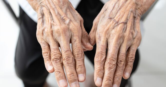 If you see someone with bulging veins, you must tell them these things