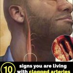 10 signs your arteries might be clogged