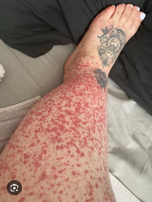 It Started with an Itch: The Alarming Hidden Cause Behind One Man’s Relentless Discomfort