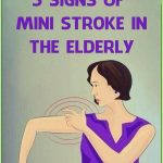 Mini Stroke in the Elderly: Common and Unusual Symptoms