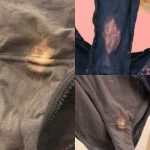What Those “Bleach” Stains on Your Underwear Really Mean
