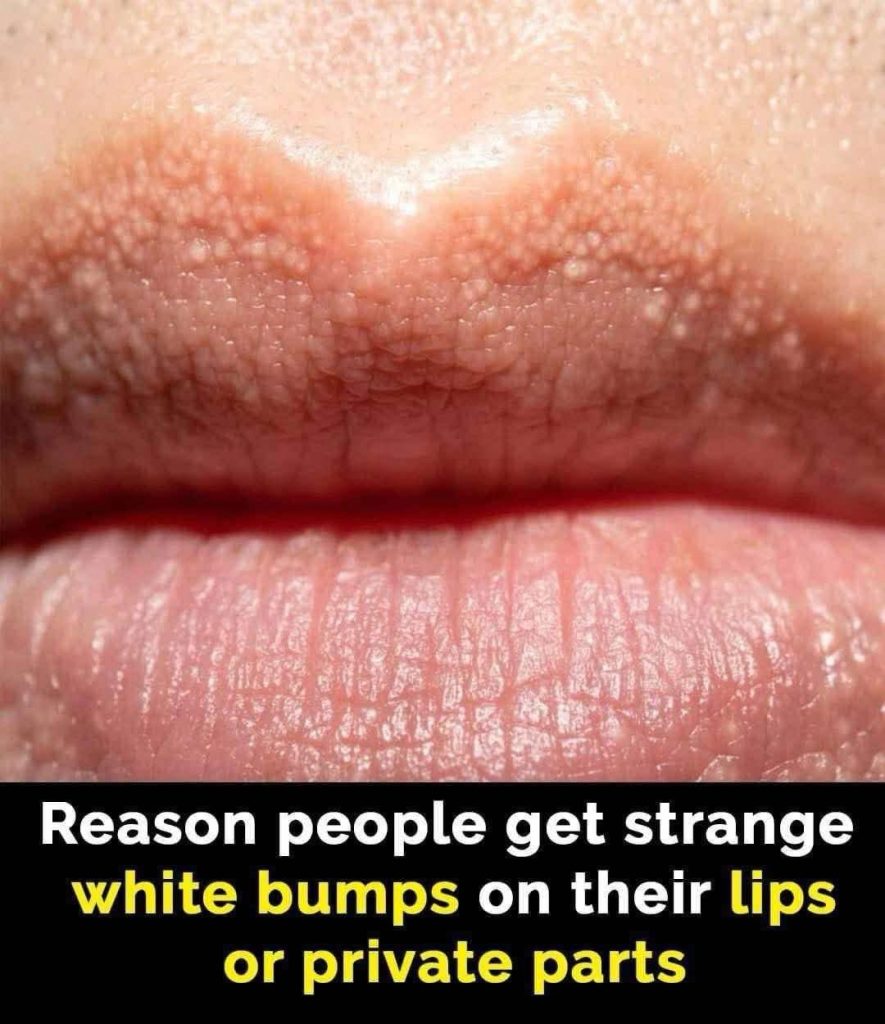 Reason behind strange white bumps found on your private parts