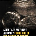 Study identifies possible connection to autism development