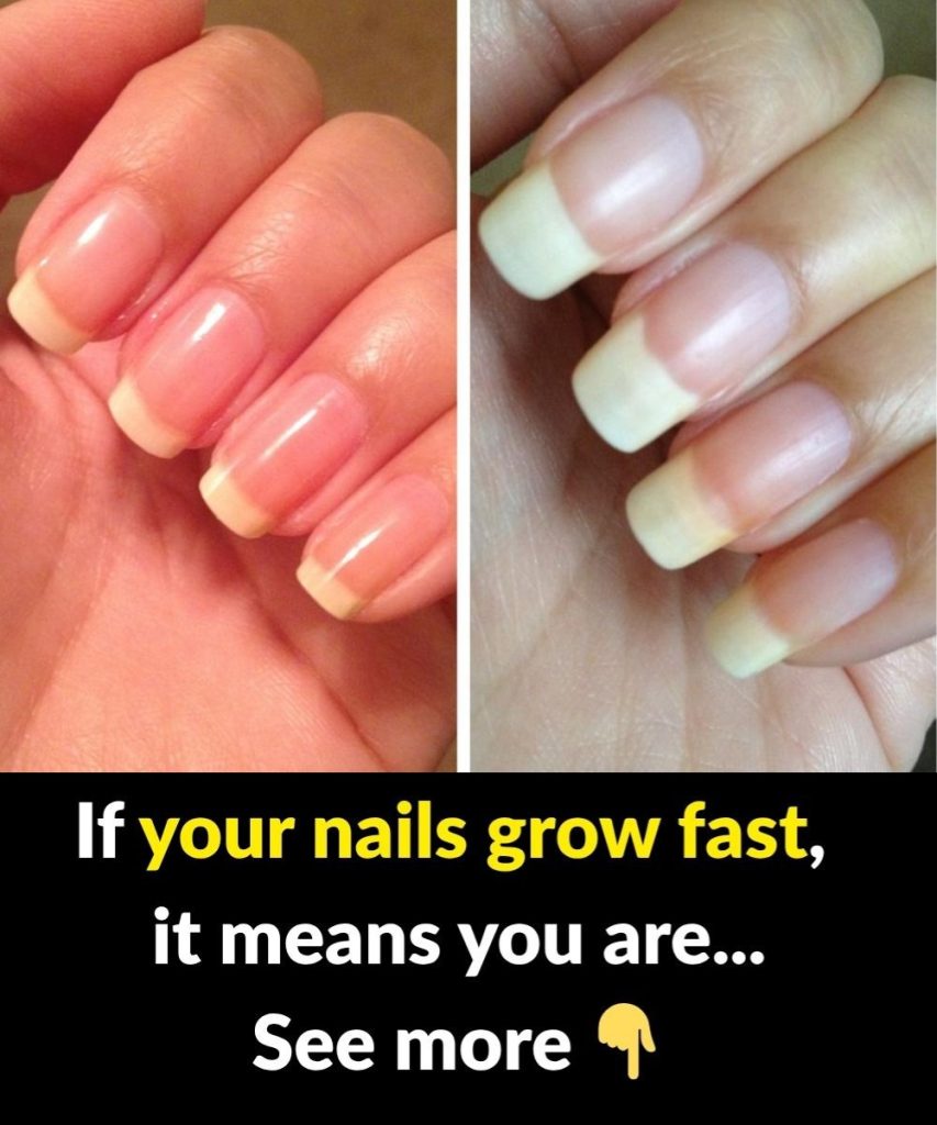 What It Really Means If Your Fingernails Grow Fast