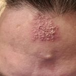 These are the consequences