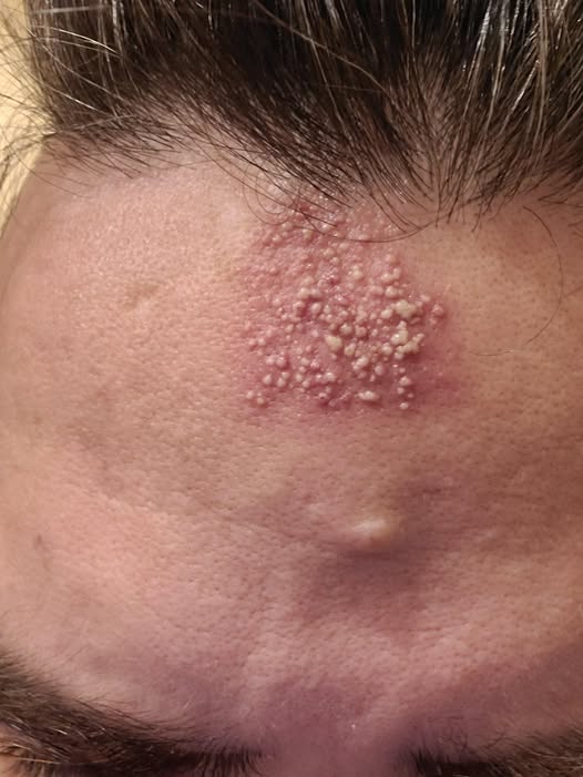 These are the consequences