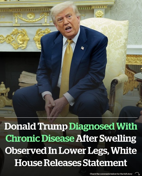 Donald Trump diagnosed