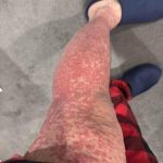 These are the consequences of sleeping with…