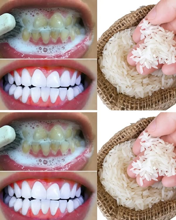 Brighten your smile naturally: Tomato teeth whitening