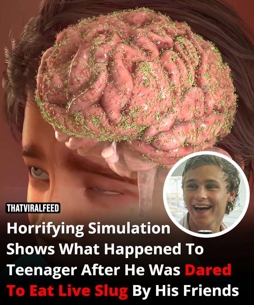 Horrifying Simulation Reveals What Happened To A Teenager After His Friends Dared Him To Eat A Live Slug