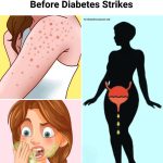 9 Early Signs of Diabetes You May Not Be Noticing