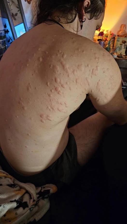 These are the consequences of sleeping with the…See more