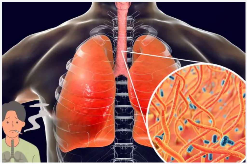How to Naturally Clear Phlegm and Mucus from Chest and Throat