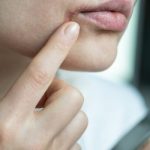 Nine ways to improve dry and flaky skin