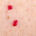 If you spot these red dots on your skin, here’s what they mean