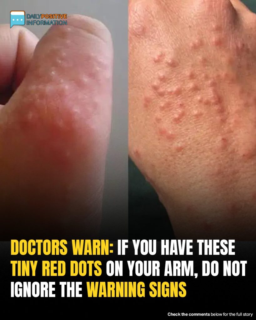 If You Have These Tiny Red Dots On Your Arm, Do Not Ignore The Warning Signs