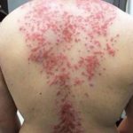 These are the consequences of sleeping with the…See more