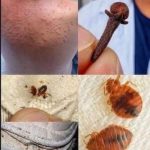 Young woman dies at the hands of her…See moreIt was itching his body, he thought it was an allergy, but a tough diagnosis… See more