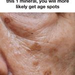 How To Reduce Age Spots: Causes, Treatment, and Prevention