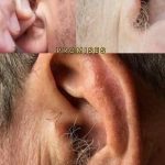 Did you know that if your ear hairs grow, it is because your body is