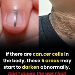 If There Are Can:cer Cells in the Bo:dy, These 5 Areas May Start to Darken Abnormally