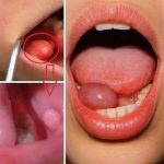 These Are The First Symptoms Of A…