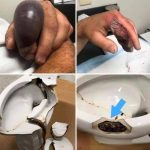 In several regions, while using their toilets, people were attacked by… see the 1st comment