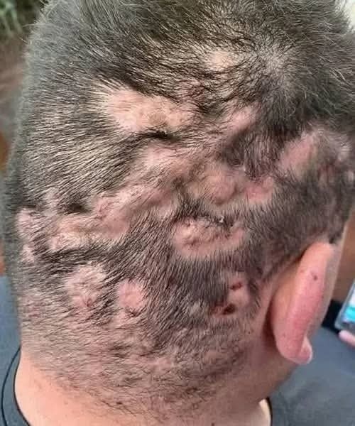 These are the first symptoms of sleeping with… See more