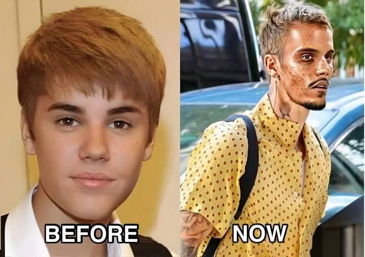 Justin Bieber Admits He Tested Positive For…