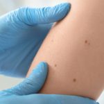 18-year-old didn’t know his symptoms were cancer until it was too late