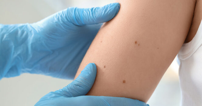 18-year-old didn’t know his symptoms were cancer until it was too late