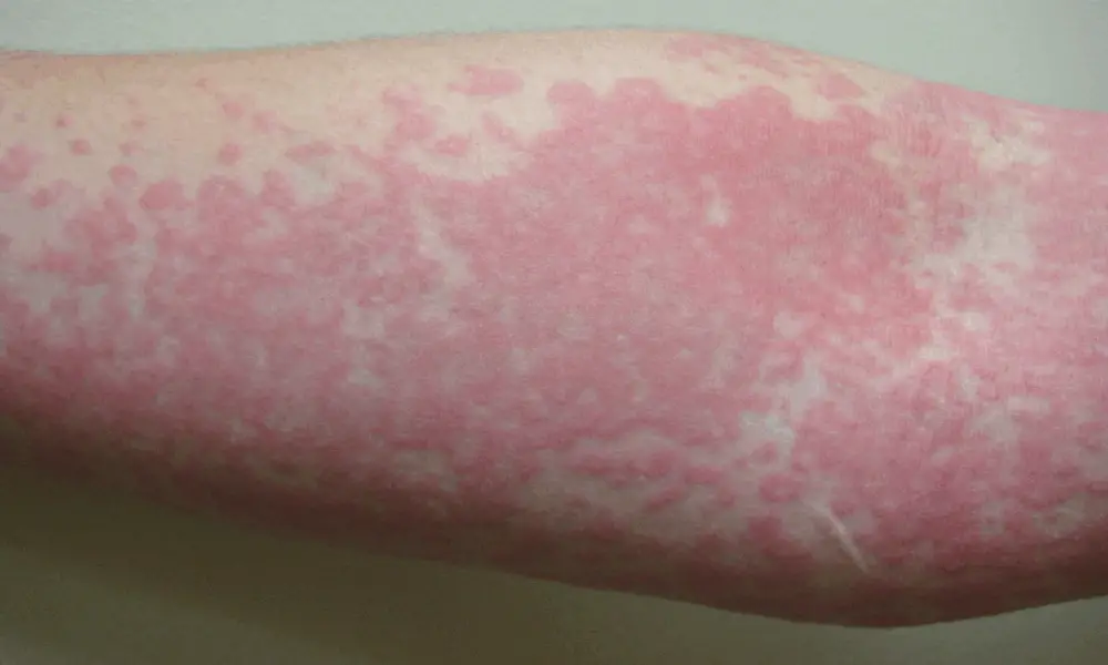 These are the consequences of sleeping with the… See more