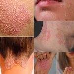 Signs you should know if you have this thing called…