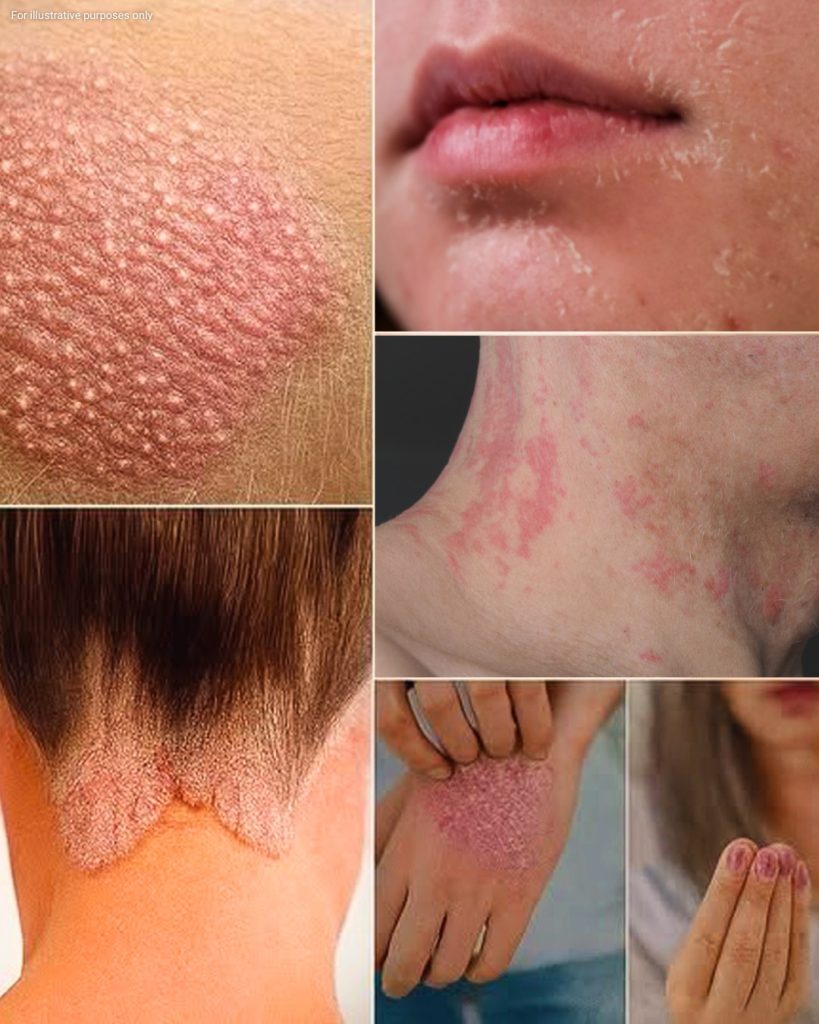 Signs you should know if you have this thing called…