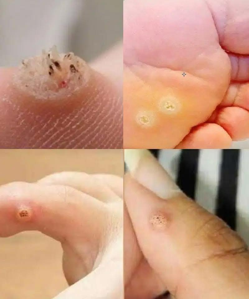 Be Aware: If You Notice These Skin Changes, See a Dermatologist