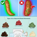 What Your Stool Color Reveals About Your Health
