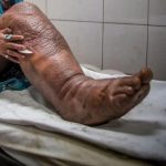 These are the consequences of sleeping with…See more