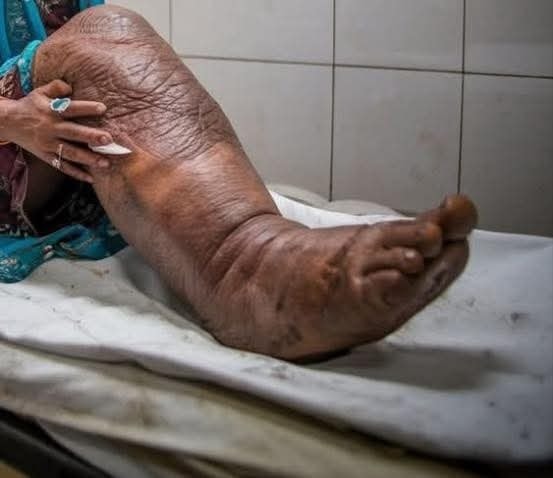 These are the consequences of sleeping with…See more